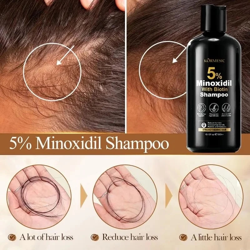 Minoxidil hair growth shampoos
