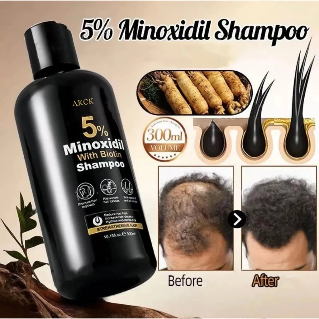 Minoxidil hair growth shampoos