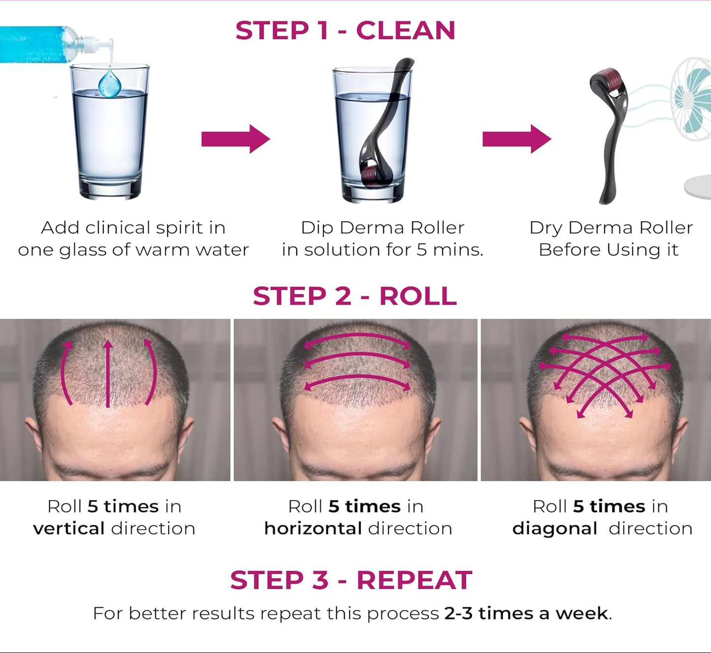 Derma Roller 0.25mm/0.5mm/0.75mm